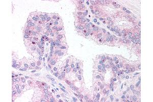 Anti-ERG antibody IHC of human prostate. (ERG Antikörper  (AA 469-481))