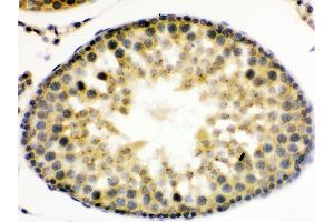 Immunohistochemistry (IHC) image for anti-UPF3 Regulator of Nonsense Transcripts Homolog B (UPF3B) (AA 416-452), (C-Term) antibody (ABIN3043956)