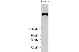 Western Blotting (WB) image for anti-Breast Cancer 2, Early Onset (BRCA2) antibody (ABIN7234156)