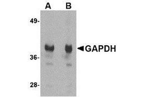 Western blot analysis of GAPDH in HeLa cell lysate with AP30356PU-N GAPDH antibody at (A) 1 and (B) 2 μg/ml. (GAPDH Antikörper  (N-Term))