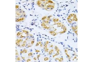 Immunohistochemistry of paraffin-embedded human stomach using CYP2E1 antibody (ABIN5971187) at dilution of 1/100 (40x lens).