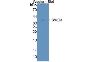 Western blot analysis of the recombinant protein. (Tensin 1 Antikörper  (AA 4-307))