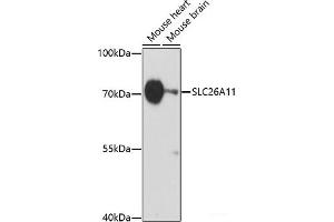 Western blot analysis of extracts of various cell lines using SLC26A11 Polyclonal Antibody at dilution of 1:1000. (SLC26A11 Antikörper)