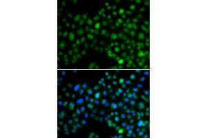 Immunofluorescence analysis of MCF7 cell using NFIL3 antibody.