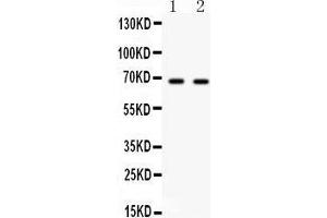 Western Blotting (WB) image for anti-Polo-Like Kinase 1 (PLK1) (AA 86-430) antibody (ABIN3043354)