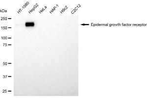 Western blotting analysis using epidermal growth factor receptor antibody (ABIN7798472). (EGFR Antikörper)