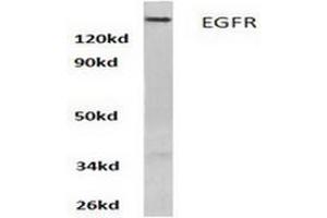 Image no. 1 for anti-Epidermal Growth Factor Receptor (EGFR) antibody (ABIN265397) (EGFR Antikörper)