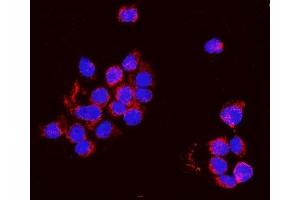 IF analysis of PNPT1 using anti-PNPT1 antibody (ABIN7599172). (PNPT1 Antikörper  (AA 1-257))