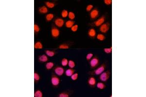 Immunofluorescence analysis of Hela cells using CH antibody (ABIN6127698, ABIN6138485, ABIN6138486 and ABIN6215383) at dilution of 1:100 (40x lens). (ZNF828 Antikörper  (AA 563-812))
