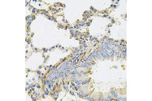 Immunohistochemistry of paraffin-embedded rat lung using UBE2B Antibody.