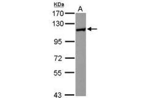 Image no. 2 for anti-Huntingtin Interacting Protein 1 Related (HIP1R) (N-Term) antibody (ABIN1494032)