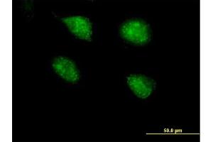Immunofluorescence of purified MaxPab antibody to PPP2R3B on HeLa cell. (PPP2R3B Antikörper  (AA 1-176))
