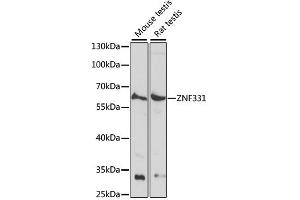 Western blot analysis of extracts of various cell lines, using ZNF331 antibody (ABIN6291097) at 1:1000 dilution. (ZNF331 Antikörper)