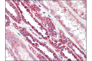 Human Kidney (formalin-fixed, paraffin-embedded) stained with TSPOat 2. (TSPO Antikörper  (C-Term))