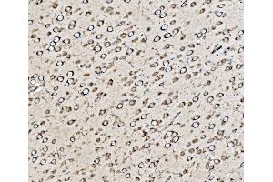 IHC analysis of Kinectin 1/KTN1 using anti-Kinectin 1/KTN1 antibody (ABIN7601096). (KTN1 Antikörper  (AA 283-827))