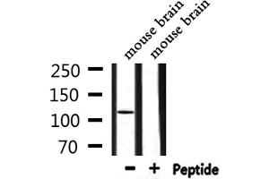 Western blot analysis of extracts from mouse brain, using ZC3H7B Antibody.