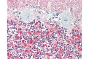Anti-VILIP / VSNL1 antibody IHC staining of human brain, cerebellum. (VSNL1 Antikörper  (AA 47-75))