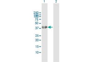 Western Blot analysis of HOXA1 expression in transfected 293T cell line by HOXA1 MaxPab polyclonal antibody. (HOXA1 Antikörper  (AA 1-335))
