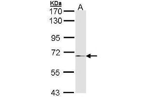 WB Image Sample (30 ug of whole cell lysate) A: Hela 7. (MMP17 Antikörper)