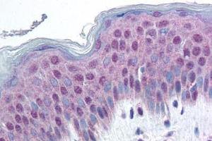 anti-High Mobility Group Nucleosome Binding Domain 1 (HMGN1) (pSer20), (Ser24) antibody
