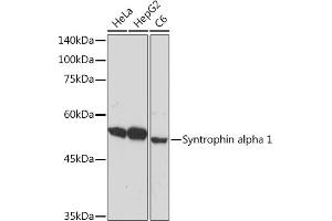 Western blot analysis of extracts of various cell lines, using Syntrophin alpha 1 Rabbit mAb (ABIN7270691) at 1:1000 dilution.