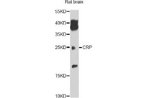 Western blot analysis of extracts of rat brain, using CRP antibody.