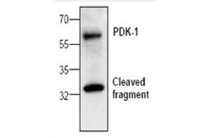 Image no. 1 for anti-3-phosphoinositide Dependent Protein Kinase-1 (PDPK1) antibody (ABIN127128) (PDPK1 Antikörper)