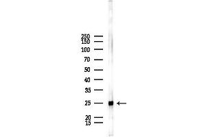 anti-Proteasome Subunit alpha 2 (PSMA2) (Internal Region) antibody