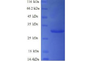 SDS-PAGE (SDS) image for Synuclein, gamma (Breast Cancer-Specific Protein 1) (SNCG) (AA 1-127), (full length) protein (His-SUMO Tag) (ABIN5710388) (SNCG Protein (AA 1-127, full length) (His-SUMO Tag))