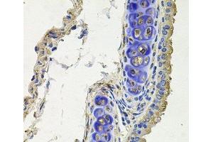Immunohistochemistry of paraffin-embedded Mouse lung using SKP1 Polyclonal Antibody at dilution of 1:100 (40x lens). (SKP1 Antikörper)