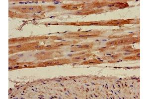 Immunohistochemistry of paraffin-embedded human heart tissue using ABIN7142910 at dilution of 1:100 (AKAP7 Antikörper  (AA 1-81))