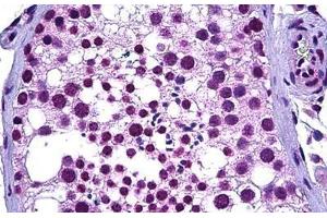 Human Testis: Formalin-Fixed, Paraffin-Embedded (FFPE) (WT1 Antikörper  (AA 349-439))