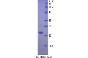 SDS-PAGE analysis of Mouse Hemoglobin beta Protein. (Hemoglobin Subunit beta Protein)