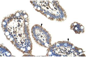 Human Intestine (DMP1 Antikörper  (C-Term))