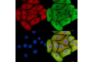 ABIN6260715 and ABIN6278829 staining Hela cells by IF/ICC. (CDK5RAP1 Antikörper  (C-Term))