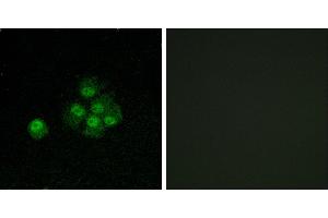 P-peptide - +Immunofluorescence analysis of MCF7 cells, using IRS-1 (Phospho-Ser636) antibody. (IRS1 Antikörper  (pSer636))