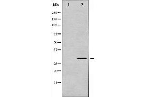 Western blot analysis of BCL-XL phosphorylation expression in UV treated 293 whole cell lysates,The lane on the left is treated with the antigen-specific peptide.