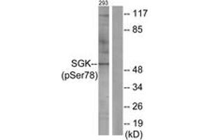 Western blot analysis of extracts from 293 cells treated with UV 15', using SGK (Phospho-Ser78) Antibody. (SGK1 Antikörper  (pSer78))