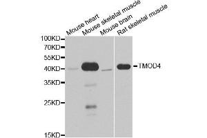 Western blot analysis of extracts of various cell lines, using TMOD4 antibody. (Tropomodulin 4 Antikörper)