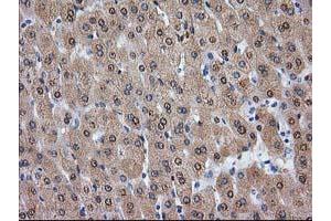 Image no. 3 for anti-Alcohol Dehydrogenase 1B (Class I), beta Polypeptide (ADH1B) antibody (ABIN1496479) (ADH1B Antikörper)