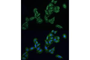 Immunofluorescence analysis of U2OS cells using AGTRAP Rabbit pAb (ABIN6130822, ABIN6136657, ABIN6136658 and ABIN6215773) at dilution of 1:100 (40x lens). (AGTRAP Antikörper  (AA 93-152))