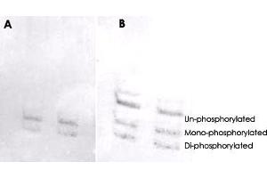 MYL6 (phospho S19/20) polyclonal antibody  was used at a 1 : 1000 dilution to detect myosin light chain by Western blot on NIH/3T3 cell lysates. (MYL6 Antikörper  (pSer19, pSer20))
