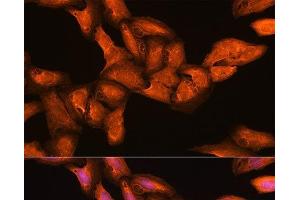 Immunofluorescence analysis of U2OS cells using BGLAP Polyclonal Antibody at dilution of 1:100. (Osteocalcin Antikörper)