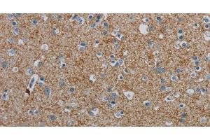 Immunohistochemistry of paraffin-embedded Human brain tissue using PGLYRP1 Polyclonal Antibody at dilution 1:40 (PGLYRP1 Antikörper)