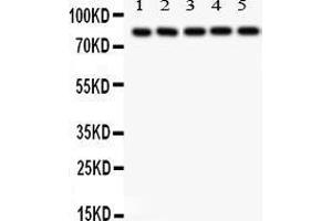 Western Blotting (WB) image for anti-SRY (Sex Determining Region Y)-Box 5 (SOX5) (AA 495-528), (C-Term) antibody (ABIN3043348)