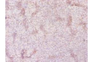 Immunohistochemistry of paraffin-embedded human tonsil tissue using ABIN7170251 at dilution of 1:20 (SLC41A2 Antikörper  (AA 1-162))