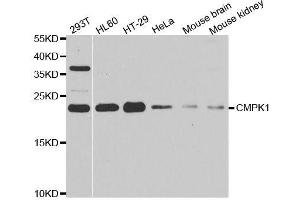 Western blot analysis of extracts of various cell lines, using CMPK1 antibody. (Cytidine Monophosphate (UMP-CMP) Kinase 1, Cytosolic (CMPK1) (AA 69-228) Antikörper)