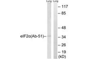 Western blot analysis of extracts from rat lung, using eIF2 alpha (Ab-51) Antibody. (EIF2A Antikörper  (AA 21-70))