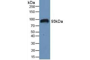 Detection of HIF1a in Human Serum using Polyclonal Antibody to Hypoxia Inducible Factor 1 Alpha (HIF1a) (HIF1A Antikörper  (AA 575-826))