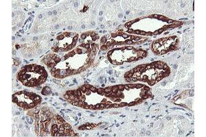 Immunohistochemical staining of paraffin-embedded Human Kidney tissue using anti-PFKP mouse monoclonal antibody. (PFKP Antikörper)